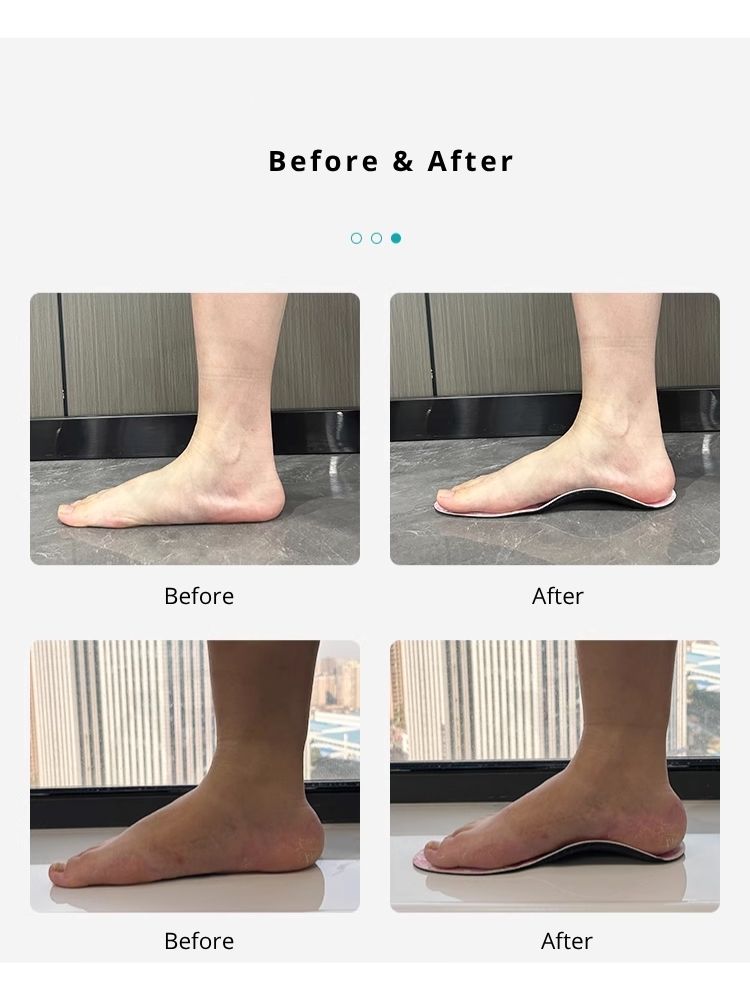 Ultra-Thin Custom Insoles for Women